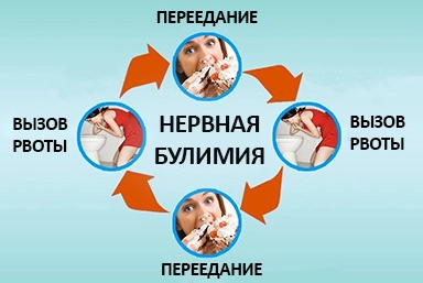 Лечение булимии в Калининской